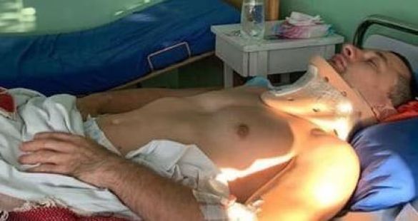 В Херсонской области на курорте мужчина сломал шею, катаясь на водном аттракционе