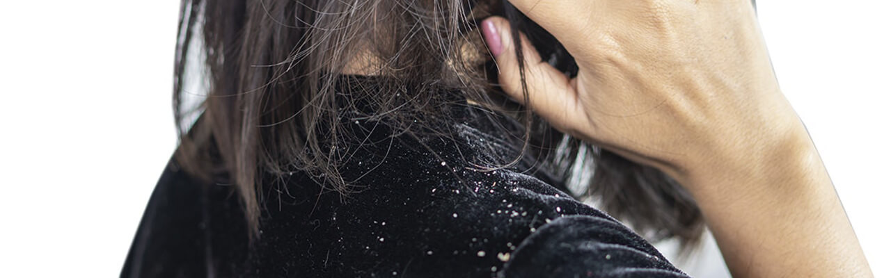 Як позбутися лупи? - Трихолог клініки NeoVita у Києві