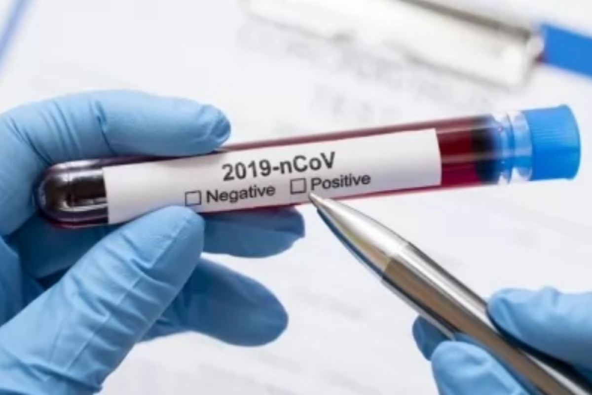 В Северодонецке в областном лабораторном центре будут делать тесты на коронавирус
