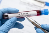 В Северодонецке в областном лабораторном центре будут делать тесты на коронавирус