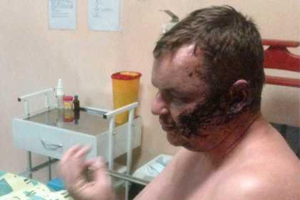 Лидер «Автомайдана» обвинил в своем похищении «русский спецназ» Лидер «Автомайдана» обвинил в своем похищении «русский спецназ»