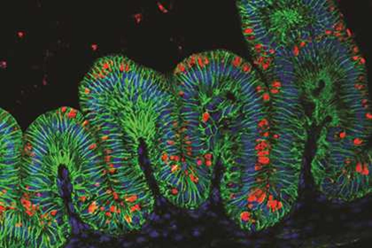 Ученые впервые вырастили ткани человеческого желудка Ученые впервые вырастили ткани человеческого желудка