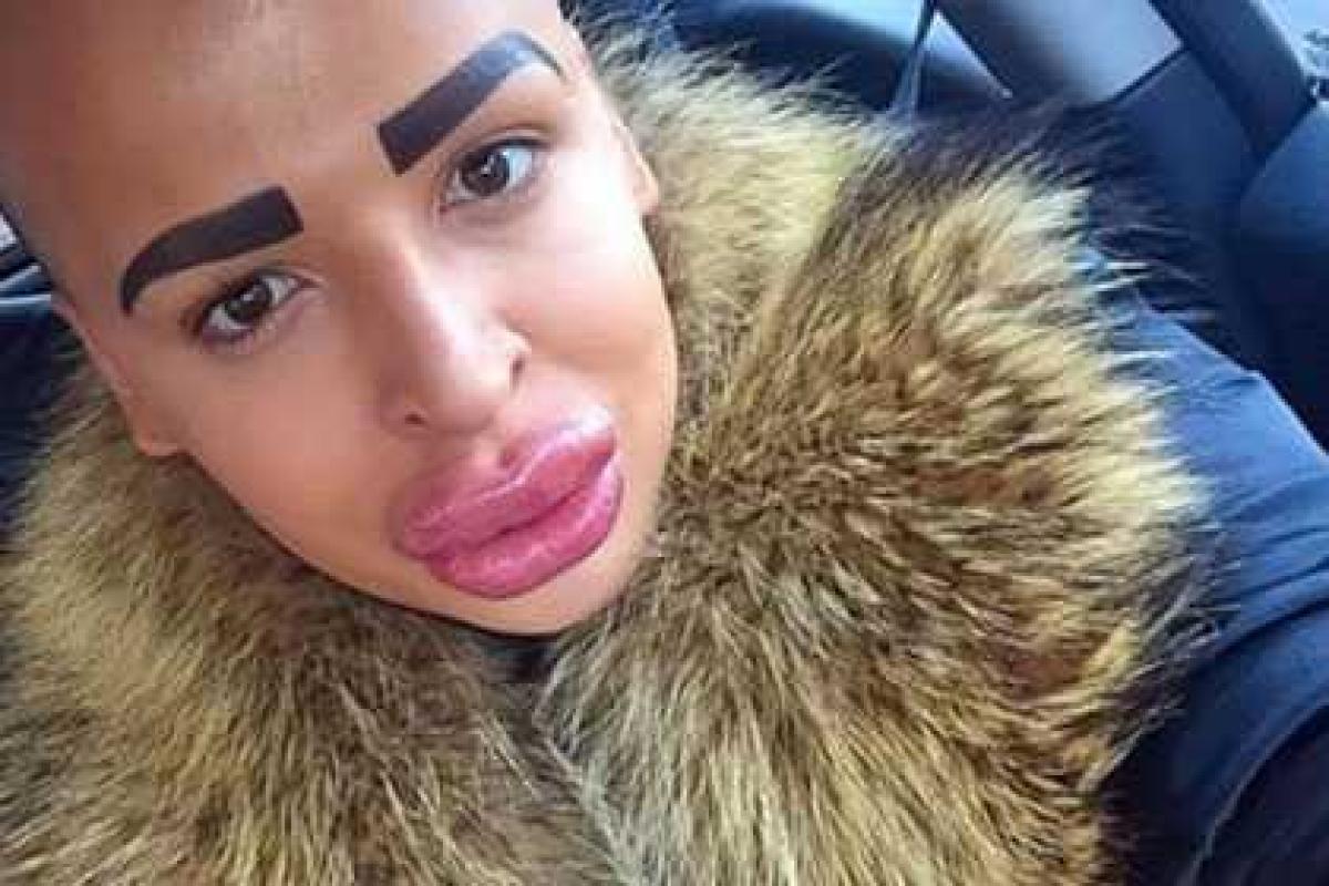 Житель Британии изуродовал себя ради сходства со звездой реалити-шоу Житель Британии изуродовал себя ради сходства со звездой реалити-шоу