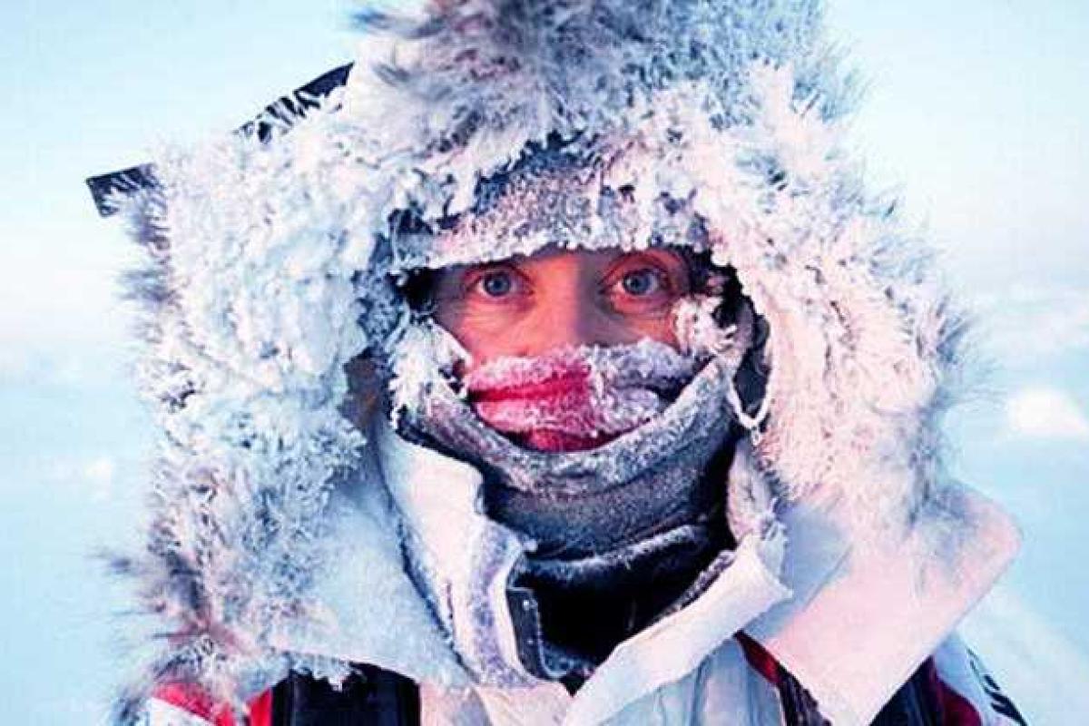 Милицейские врачи Волыни предостерегают граждан от обморожения Милицейские врачи Волыни предостерегают граждан от обморожения