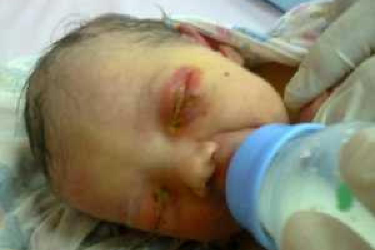 Заживо закопанная новорожденная девочка выжила, несмотря на все старания матери ее убить