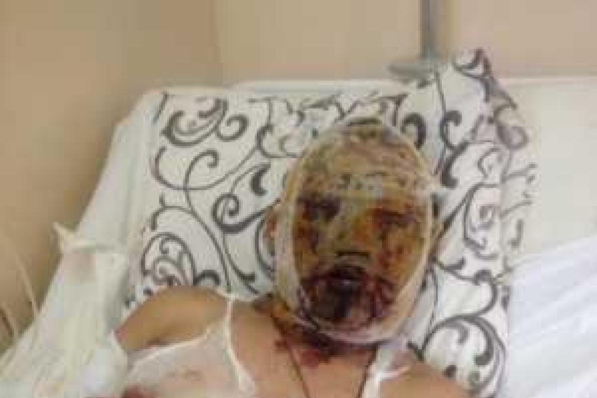 Был нужен, пока убивал на Донбассе: раненый российский "доброволец" пытается выжить Был нужен, пока убивал на Донбассе: раненый российский "доброволец" пытается выжить