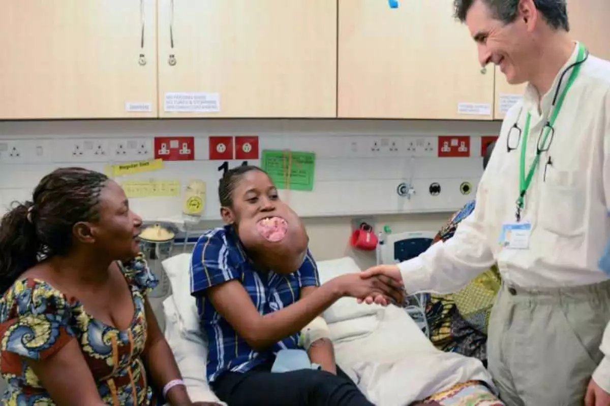 Победа медиков: девушке на лице удалили опухоль размером с футбольный мяч 