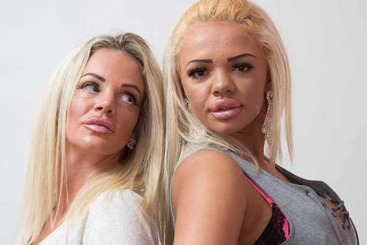 Красота - страшная сила: как мать и дочь изуродовали себя пластическими операциями Красота - страшная сила: как мать и дочь изуродовали себя пластическими операциями