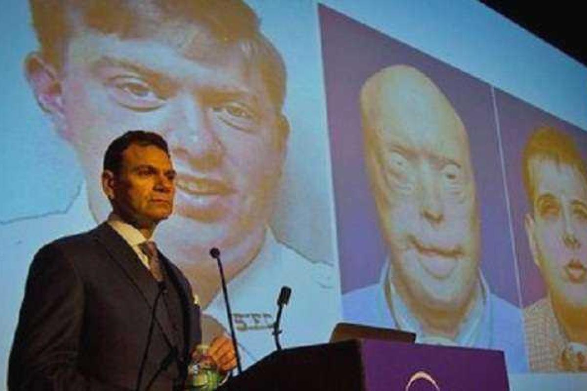 Американские медики подарили обгоревшему пожарному новое лицо