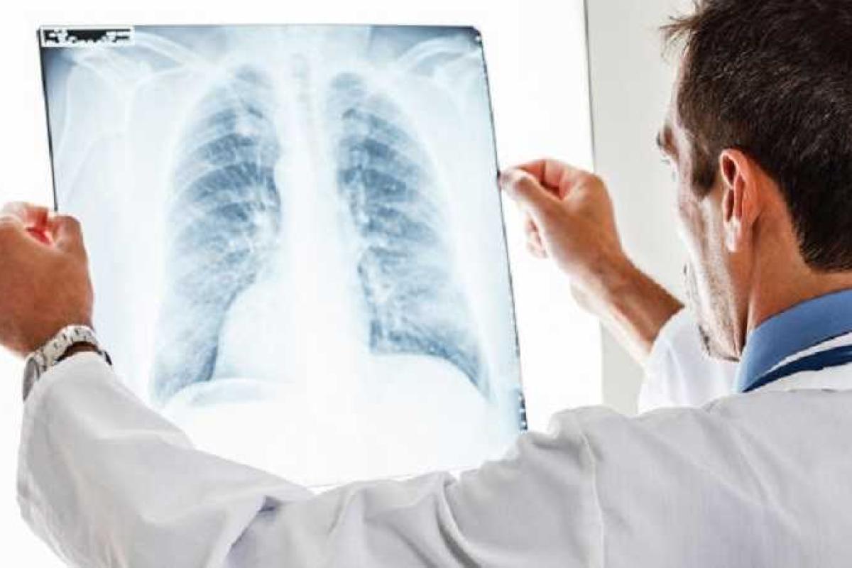 В литовском городе Скуодас учительница заразила туберкулезом 77 детей