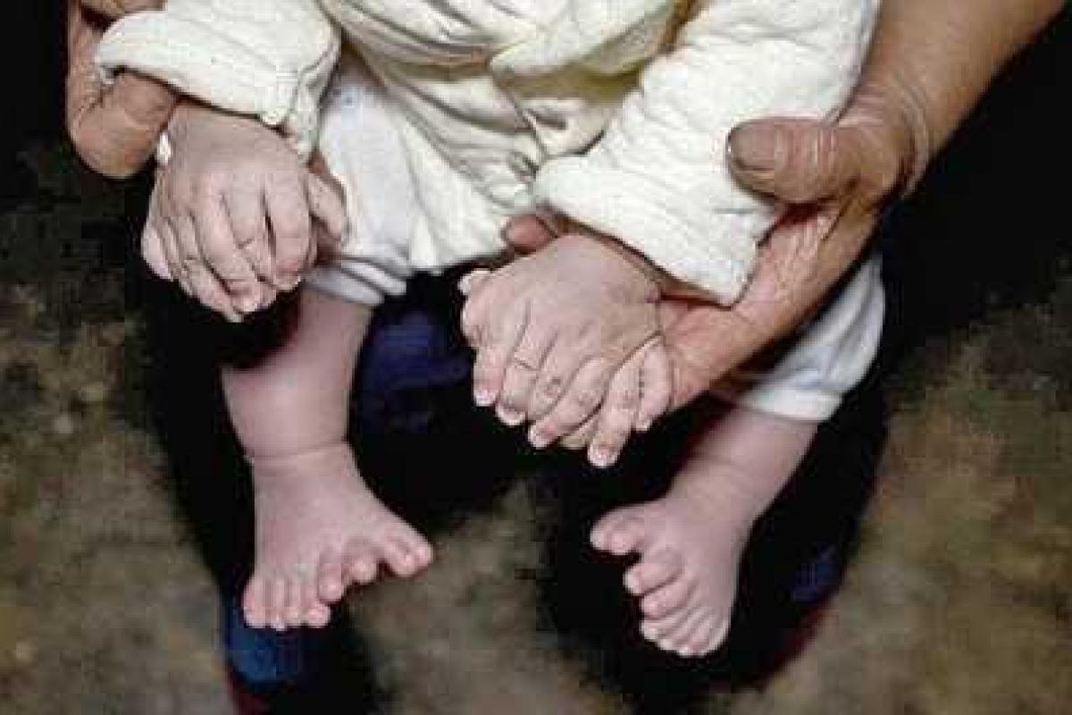 В Китае родился необычный ребенок