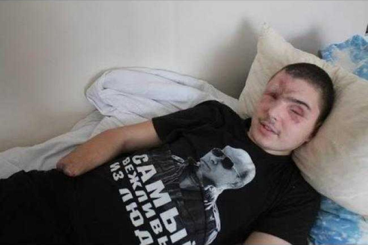 Степова: кто после войны будет содержать покалеченных "ветеранов Новороссии"? Степова: кто после войны будет содержать покалеченных "ветеранов Новороссии"?