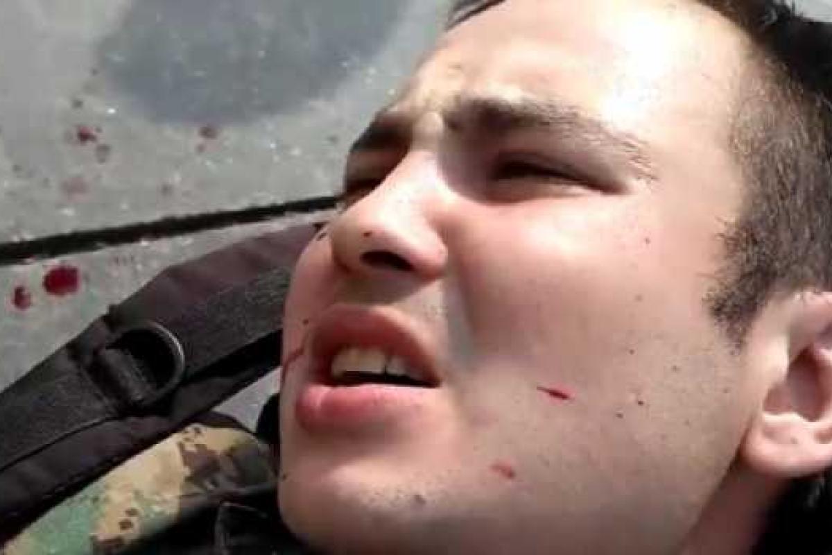 В Киеве нанесли 8 ножевых ранений добровольцу ОУН, пострадавший находится в реанимации В Киеве нанесли 8 ножевых ранений добровольцу ОУН, пострадавший находится в реанимации