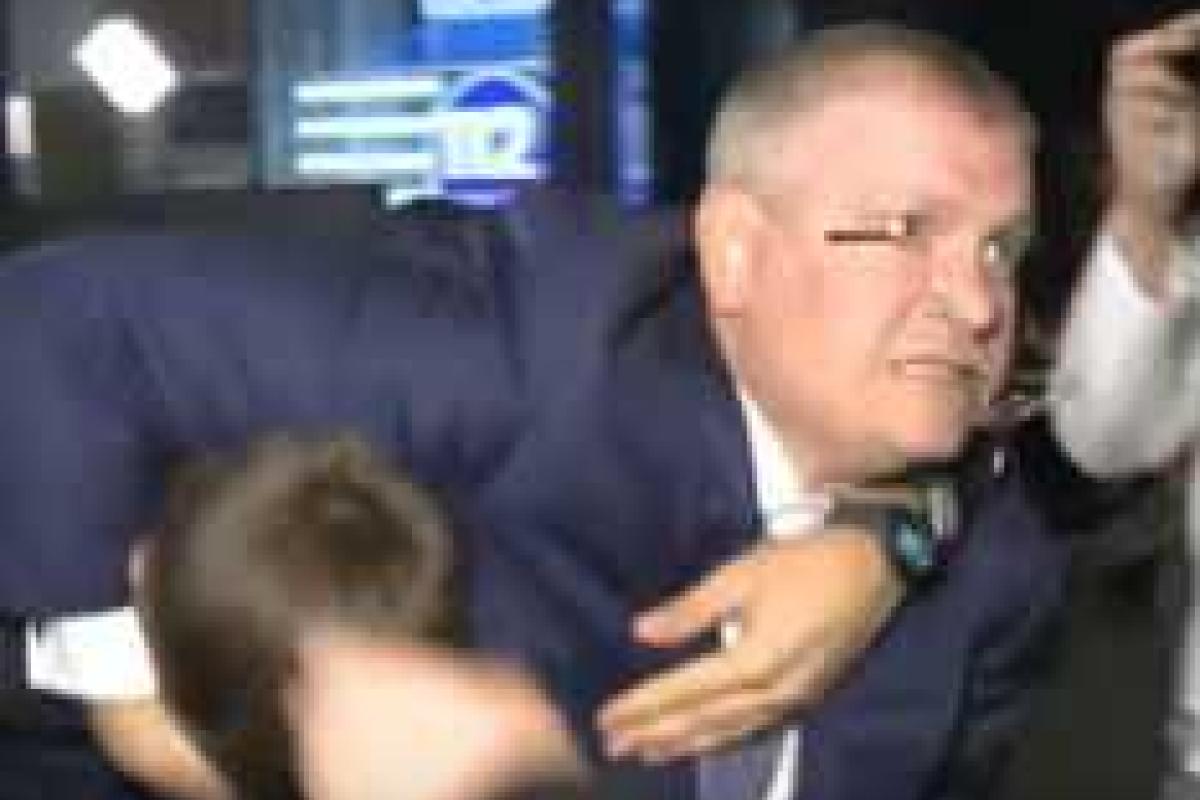 Вилкул показал свои "боевые" ранения, полученные в драке с Парасюком