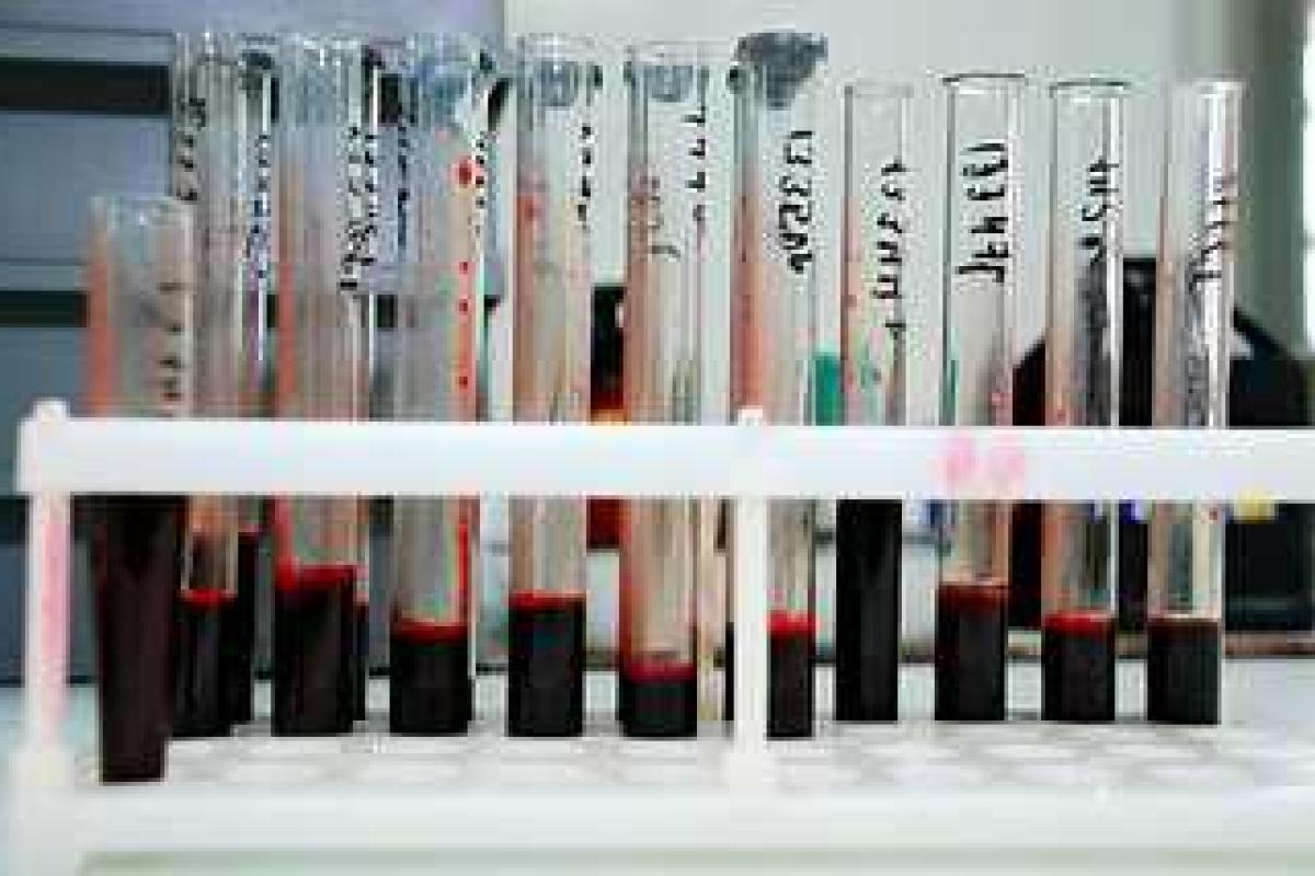 В "ДНР" растет количество ВИЧ-инфицированных: лекарств катастрофически не хватает В "ДНР" растет количество ВИЧ-инфицированных: лекарств катастрофически не хватает