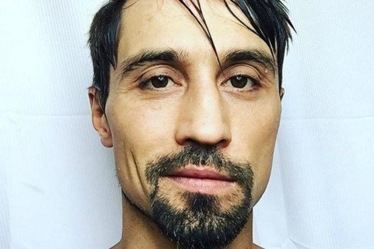 Скандальная блогер Лена Миро предположила, чем на самом деле болен Дима Билан