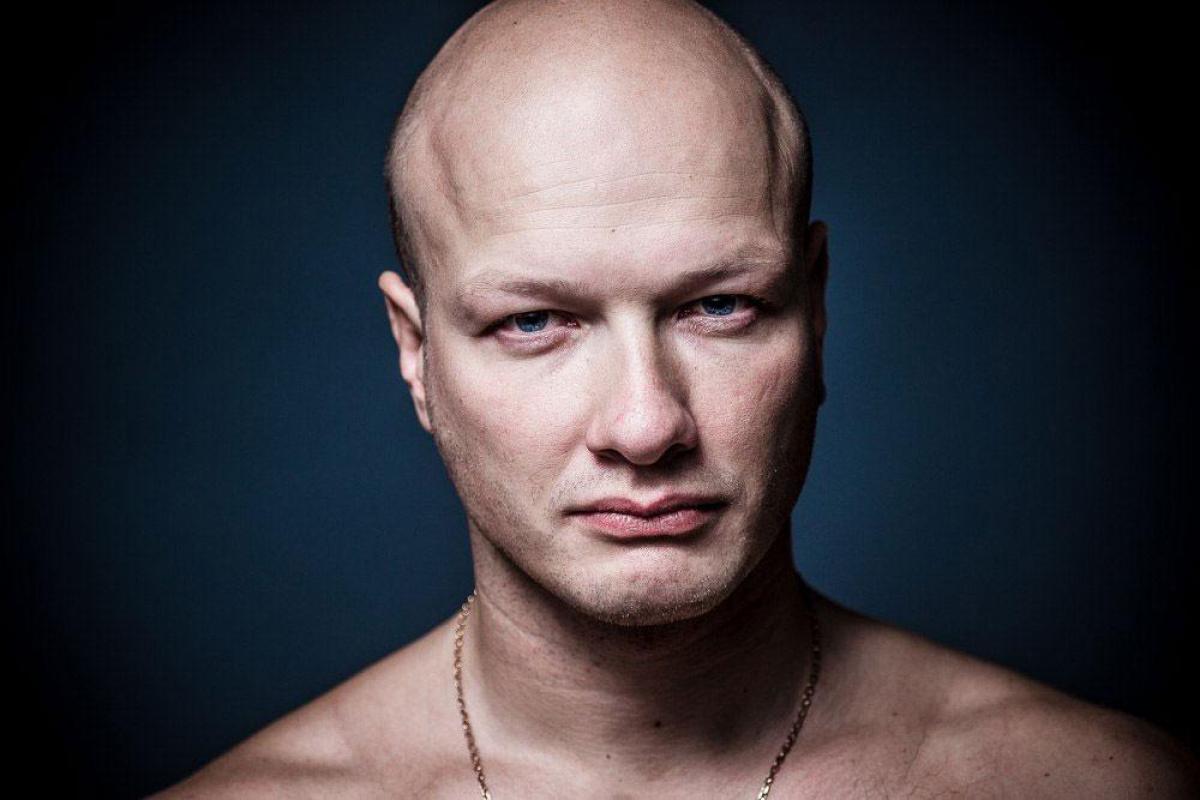 Никита Панфилов на съемочной площадке получил травму головы: актеру пришлось наложить швы