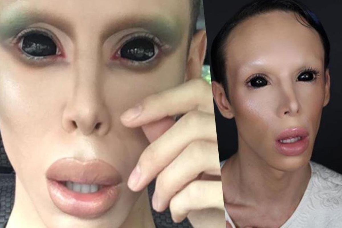 Американец мечтает превратиться в инопланетянина: уже проведено более 110 пластических операций Американец мечтает превратиться в инопланетянина: уже проведено более 110 пластических операций