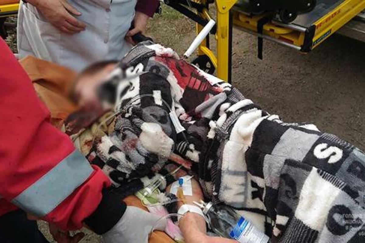 На Днепропетровщине подростки едва не убили школьника из-за компьютера: мальчик в реанимации На Днепропетровщине подростки едва не убили школьника из-за компьютера: мальчик в реанимации
