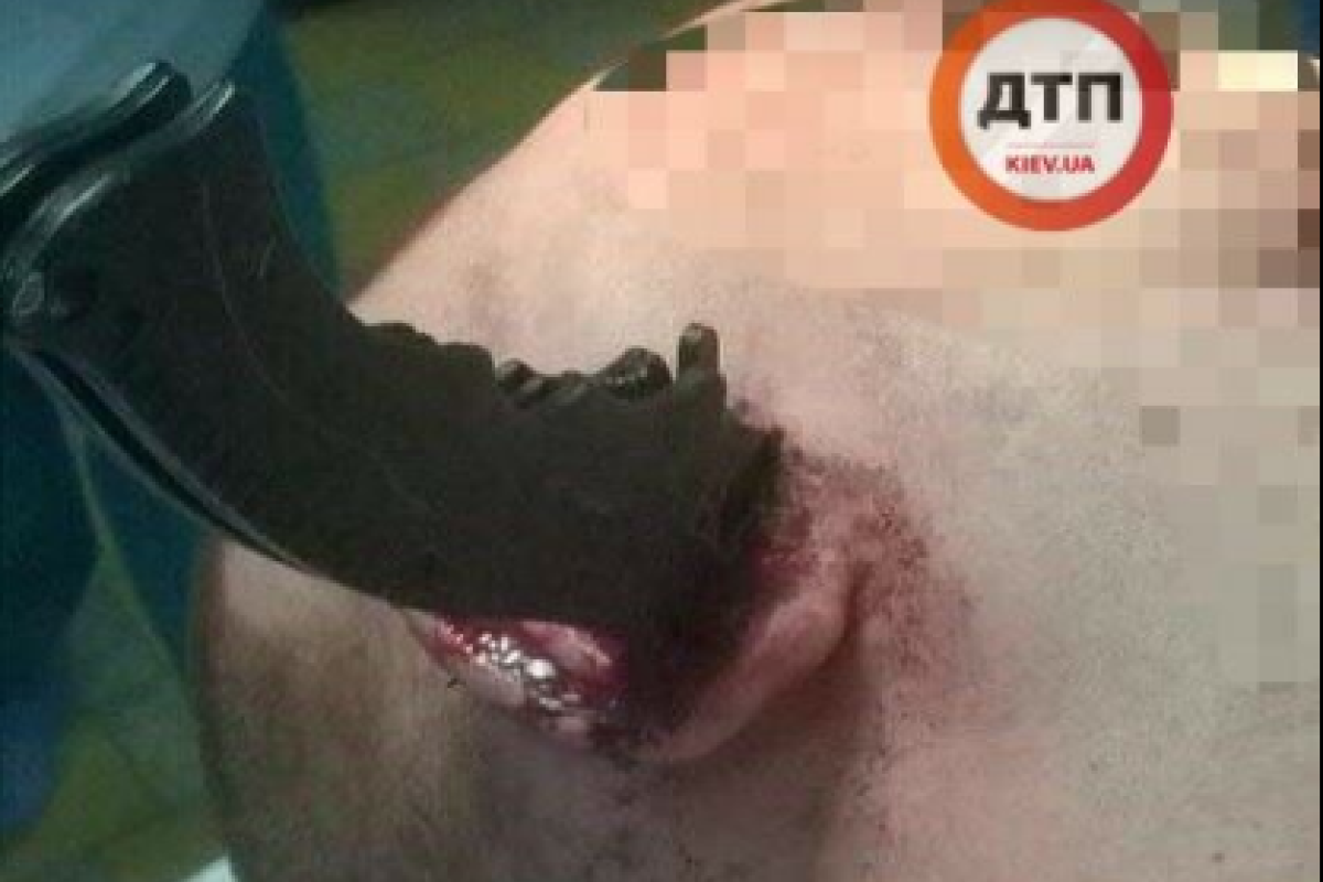"Нож вошел в ухо по самую рукоятку": В Киеве совершено зверское нападение на мужчину
