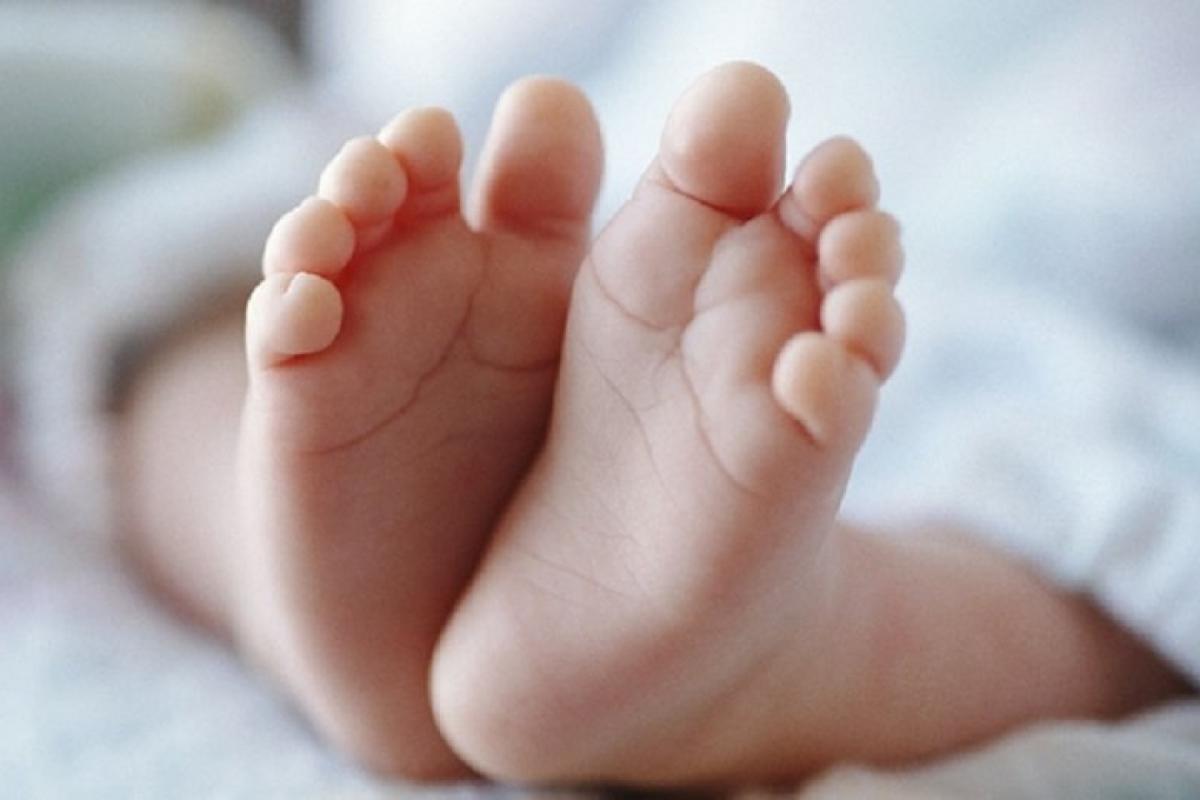 В Португалии родился ребенок без лица: у мальчика нет носа и глаз