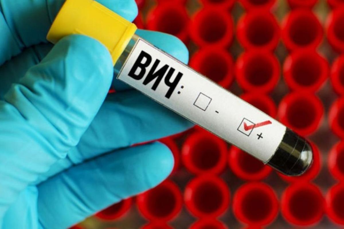 Прорыв в лечении ВИЧ: разработана действенная экспериментальная вакцина Прорыв в лечении ВИЧ: разработана действенная экспериментальная вакцина