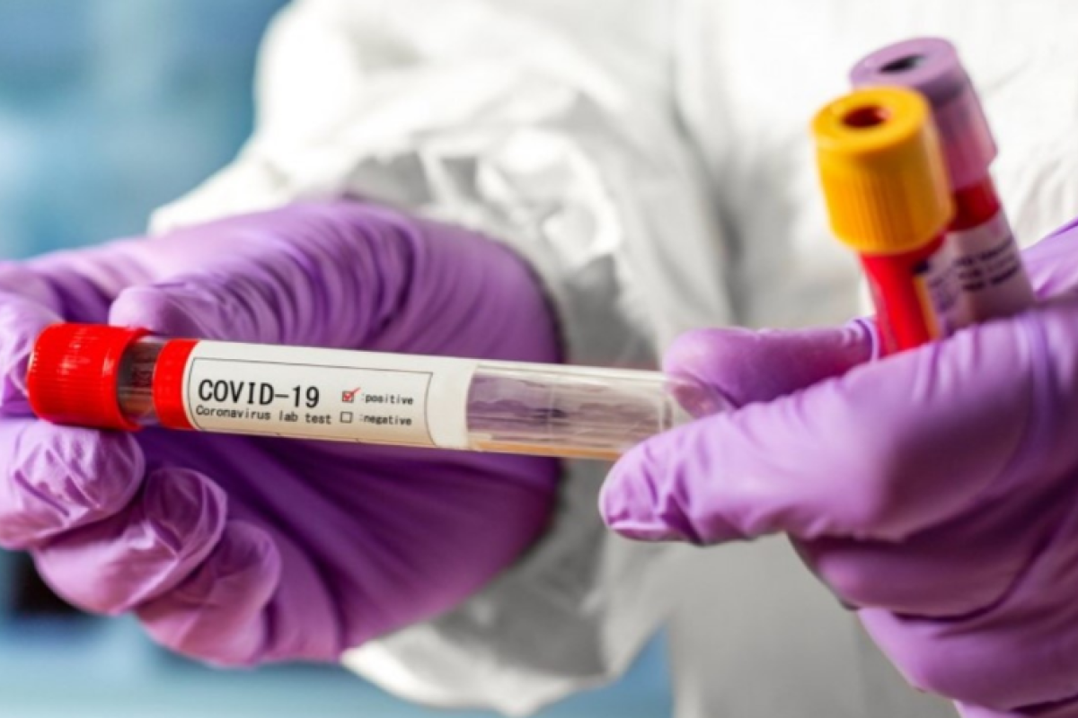 В Украине зафиксировано 19230 случаев COVID-19: статистика заболеваемости по регионам В Украине зафиксировано 19230 случаев COVID-19: статистика заболеваемости по регионам