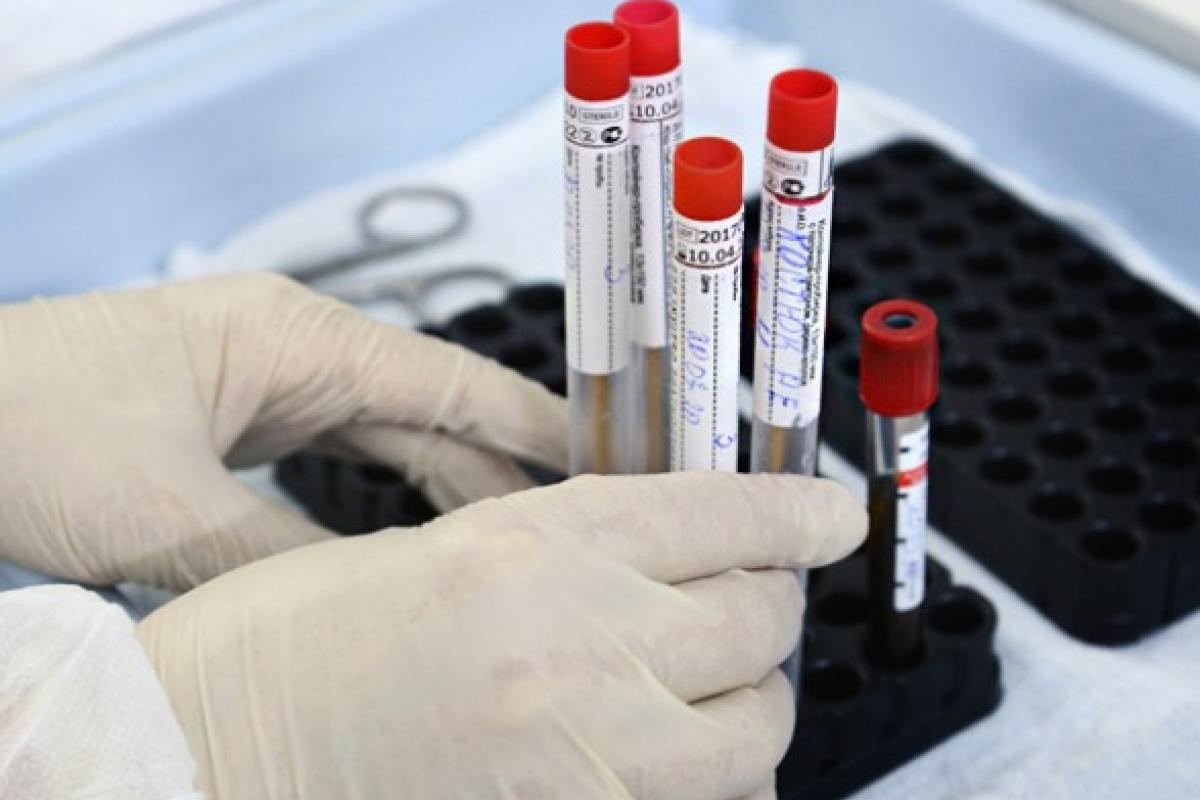 Коронавирус не отступает: В Украине за сутки подтверждено 588 новых случаев COVID-19 Коронавирус не отступает: В Украине за сутки подтверждено 588 новых случаев COVID-19