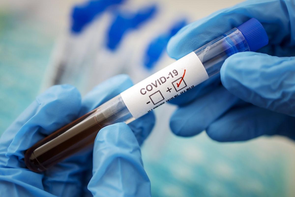 Новый антирекорд: В Украине за сутки число больных COVID-19 увеличилось на 1106 человек Новый антирекорд: В Украине за сутки число больных COVID-19 увеличилось на 1106 человек