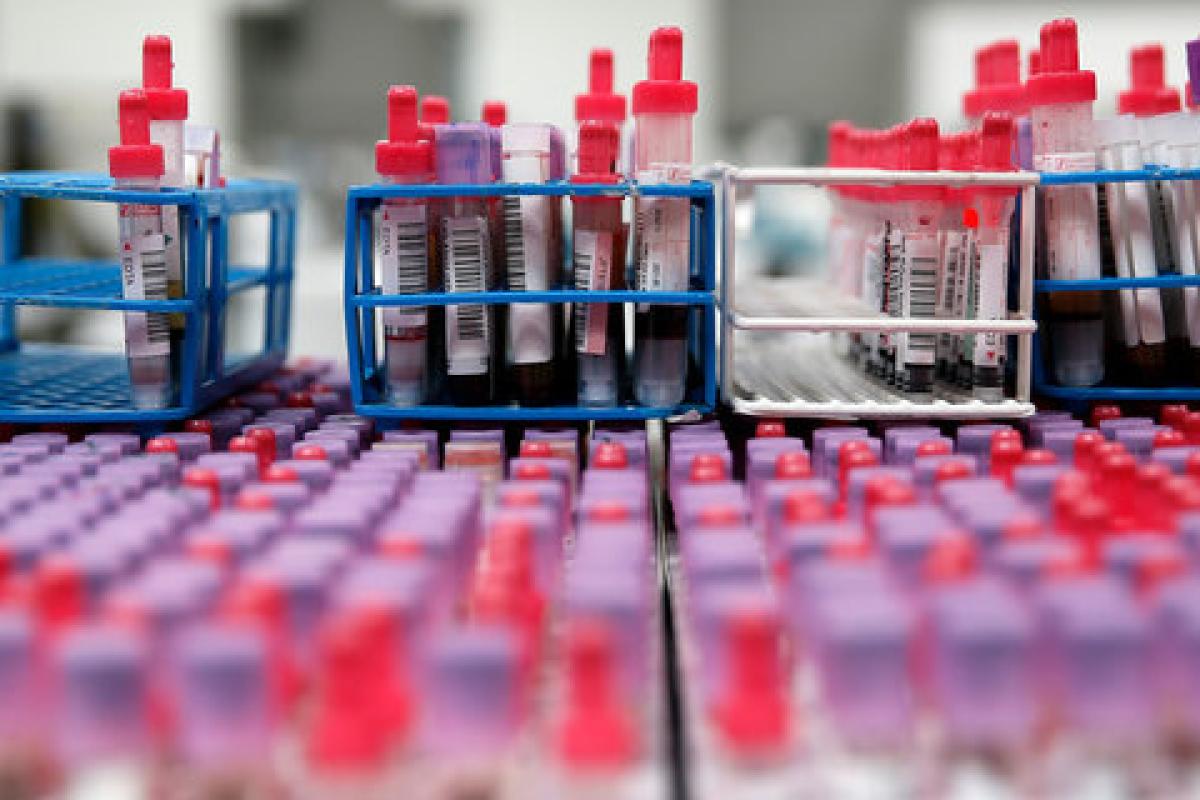 Коронавірус не відступає: В Україні 810 нових випадків COVID-19 за добу Коронавірус не відступає: В Україні 810 нових випадків COVID-19 за добу