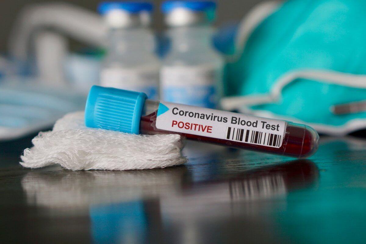 На Луганщине 10 случаев COVID-19 за сутки: число больных в Северодонецке перевалило за полсотни На Луганщине 10 случаев COVID-19 за сутки: число больных в Северодонецке перевалило за полсотни