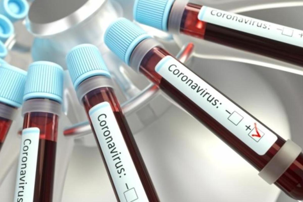 COVID-19 в Украине: актуальная статистика заражения по регионам COVID-19 в Украине: актуальная статистика заражения по регионам