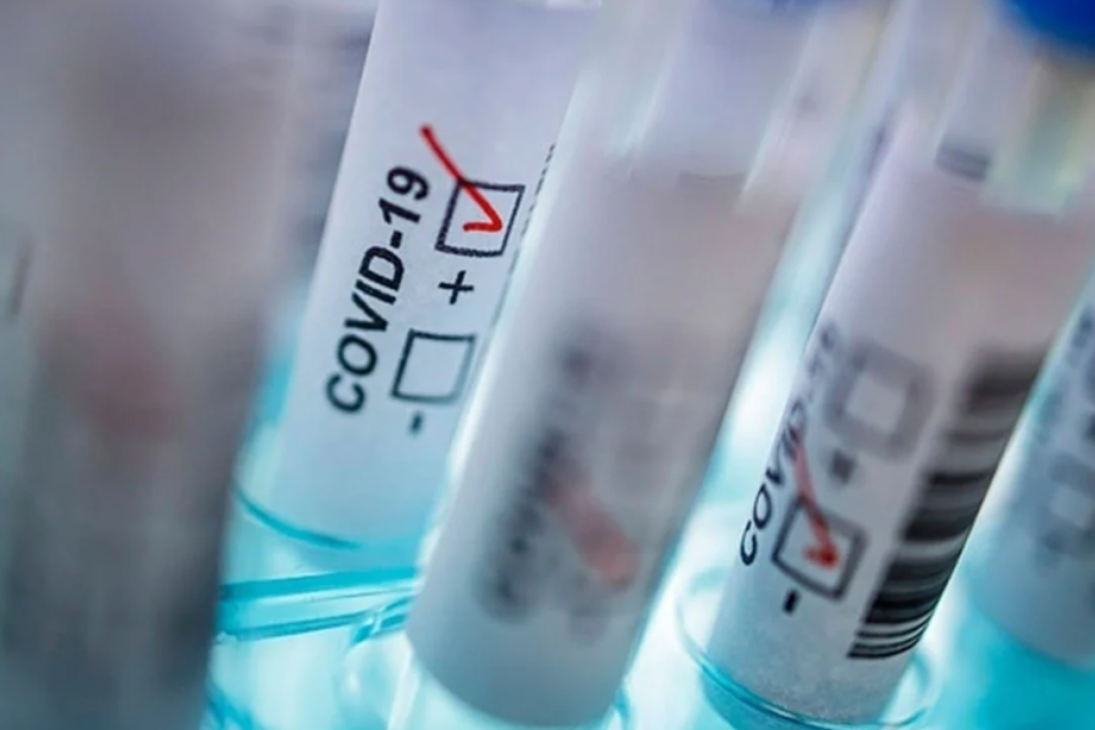 Коронавірус не відступає: актуальна інформація щодо COVID-19 по регіонах України Коронавірус не відступає: актуальна інформація щодо COVID-19 по регіонах України
