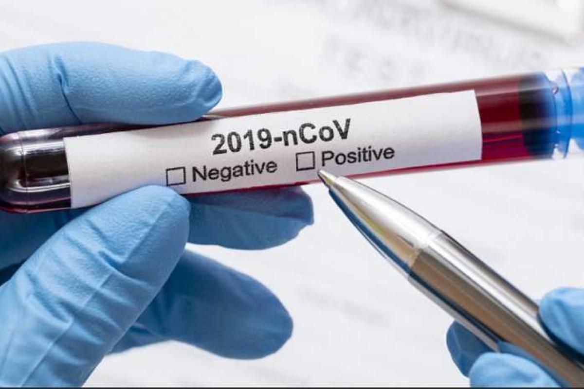 COVID-19 на Луганщині: зафіксовано 105 нових випадків та 4 смерті COVID-19 на Луганщині: зафіксовано 105 нових випадків та 4 смерті