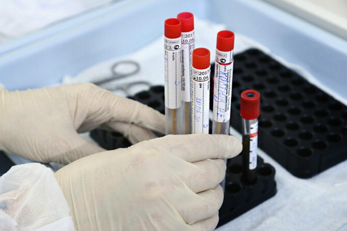В Украине +6 677 новых случаев COVID-19: официальная статистика по коронавирусу В Украине +6 677 новых случаев COVID-19: официальная статистика по коронавирусу