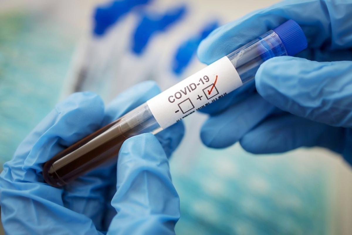 COVIND-19 у Лисичанську: офіційна інформація про кількість хворих у школах та дитсадках міста COVIND-19 у Лисичанську: офіційна інформація про кількість хворих у школах та дитсадках міста