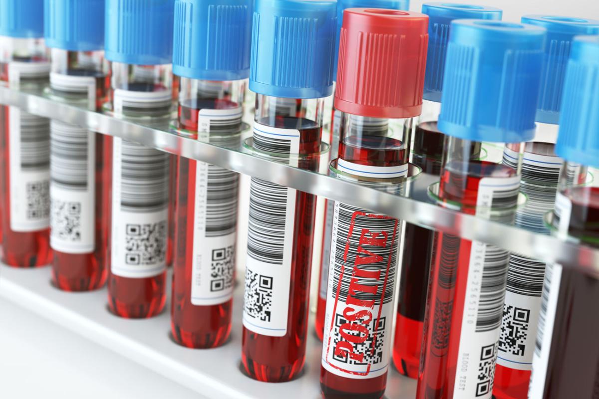 В Украине зафиксировано более 9,5 тысяч новых случаев COVID-19: данные по регионам В Украине зафиксировано более 9,5 тысяч новых случаев COVID-19: данные по регионам