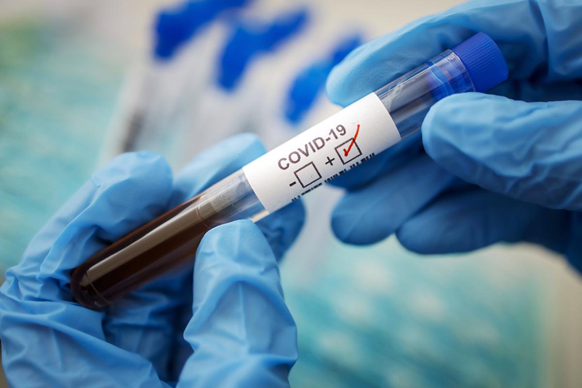 В Украине обнаружили более 10 тысяч новых случаев COVID-19: данные по регионам В Украине обнаружили более 10 тысяч новых случаев COVID-19: данные по регионам