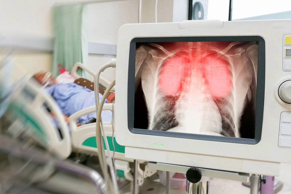 Рекорд с начала пандемии: В Украине обнаружили более 20 тысяч случаев COVID-19 за сутки Рекорд с начала пандемии: В Украине обнаружили более 20 тысяч случаев COVID-19 за сутки