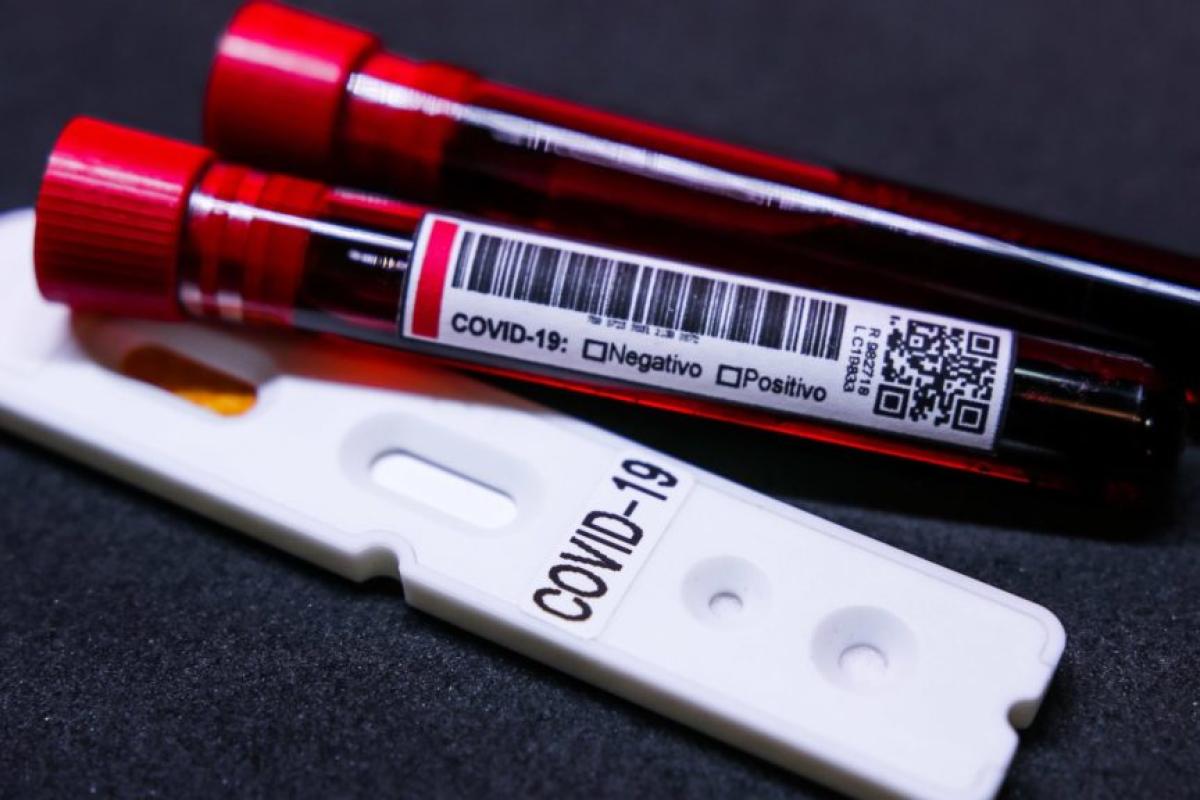 В Україні зафіксовано менше 800 нових випадків COVID-19 за добу: статистика МОЗ