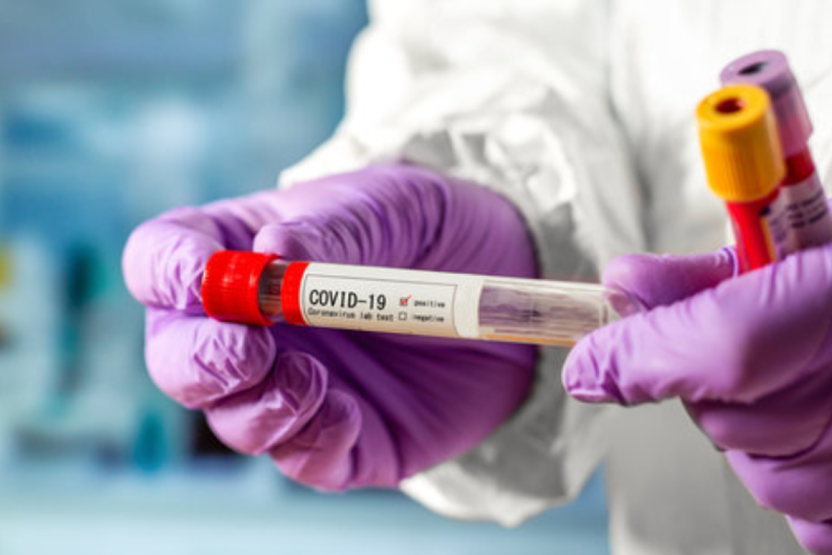 В Україні за добу більше тисячі нових випадків COVID-19: статистика МОЗ В Україні за добу більше тисячі нових випадків COVID-19: статистика МОЗ