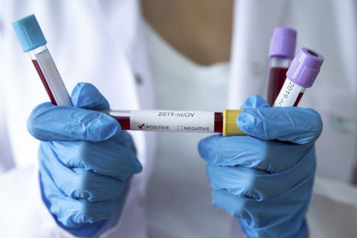 В Україні за добу підтвердили 876 нових випадків COVID-19 В Україні за добу підтвердили 876 нових випадків COVID-19
