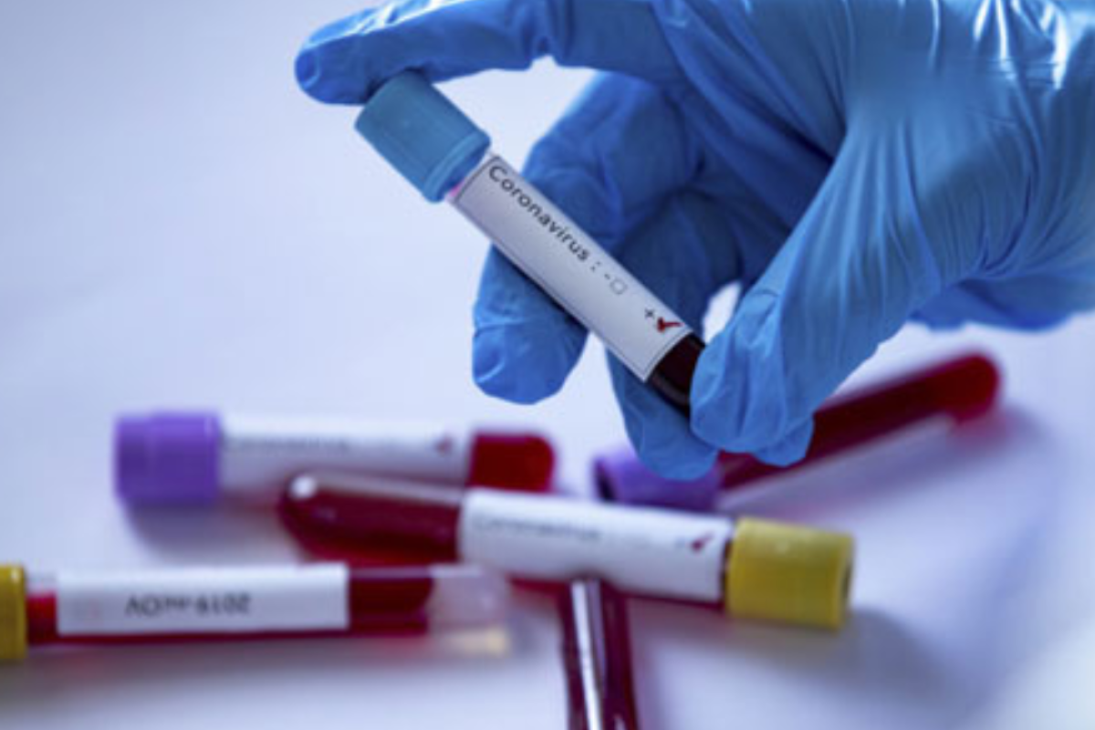 В Украине за сутки зафиксировано 2137 новых случаев инфицирования COVID-19 В Украине за сутки зафиксировано 2137 новых случаев инфицирования COVID-19