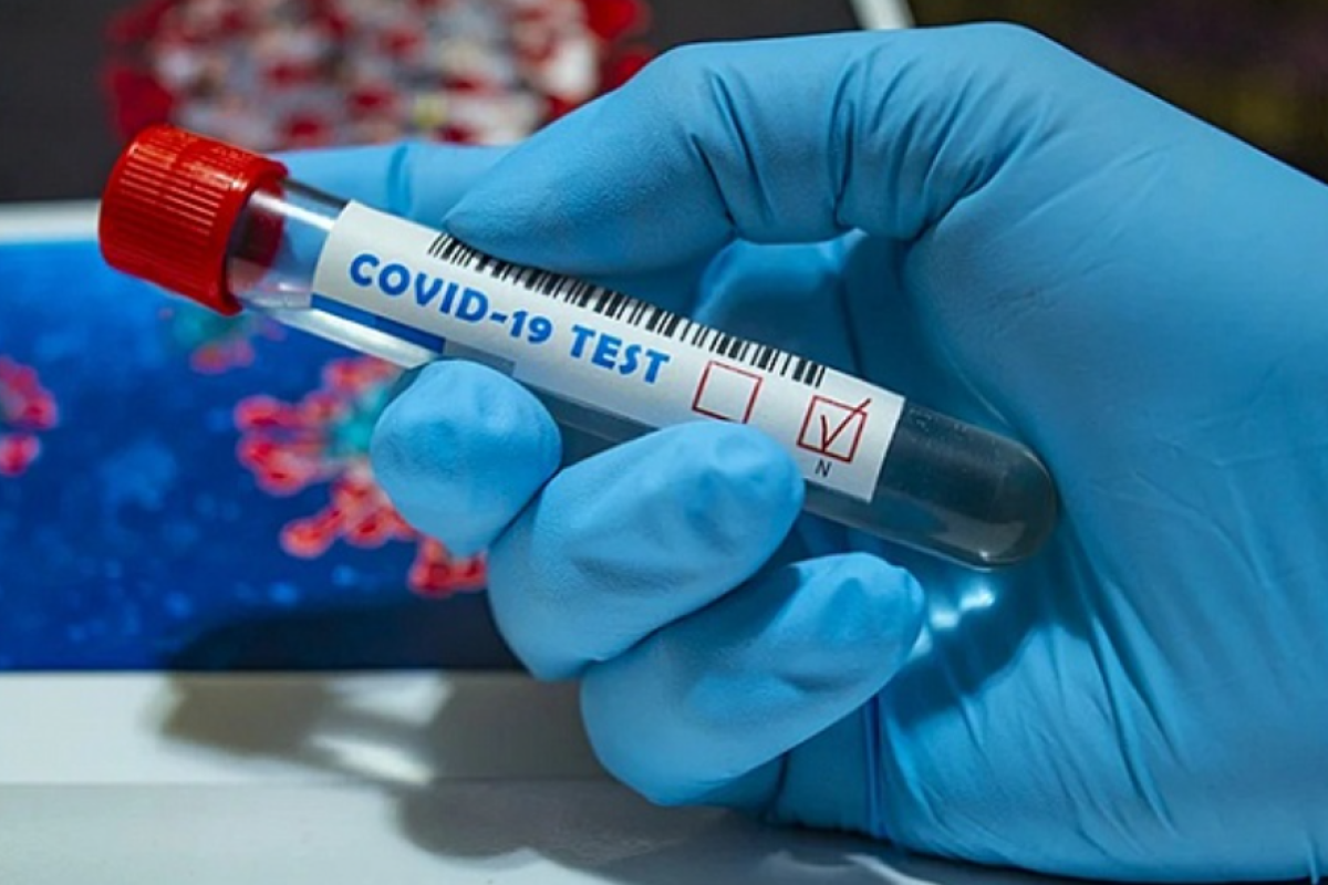 В Україні за добу підтвердили 705 нових випадків COVID-19: статистика МОЗ В Україні за добу підтвердили 705 нових випадків COVID-19: статистика МОЗ