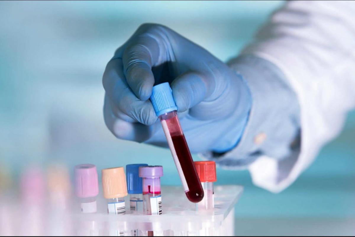 В Україні за добу зафіксовано більше тисячі нових випадків COVID-19 В Україні за добу зафіксовано більше тисячі нових випадків COVID-19