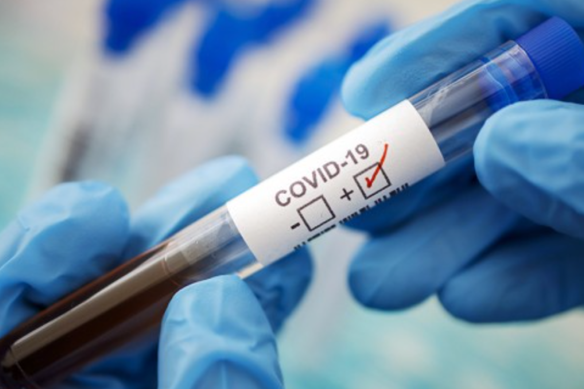 В Украине за сутки зафиксировано 26 198 новых случаев инфицирования COVID-19