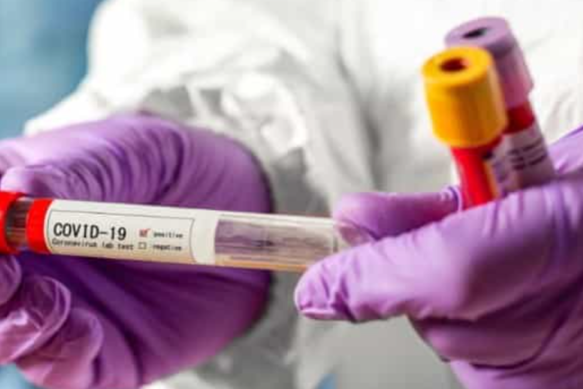 В Україні за добу зафіксовано 7 464 нових випадків інфікування COVID-19