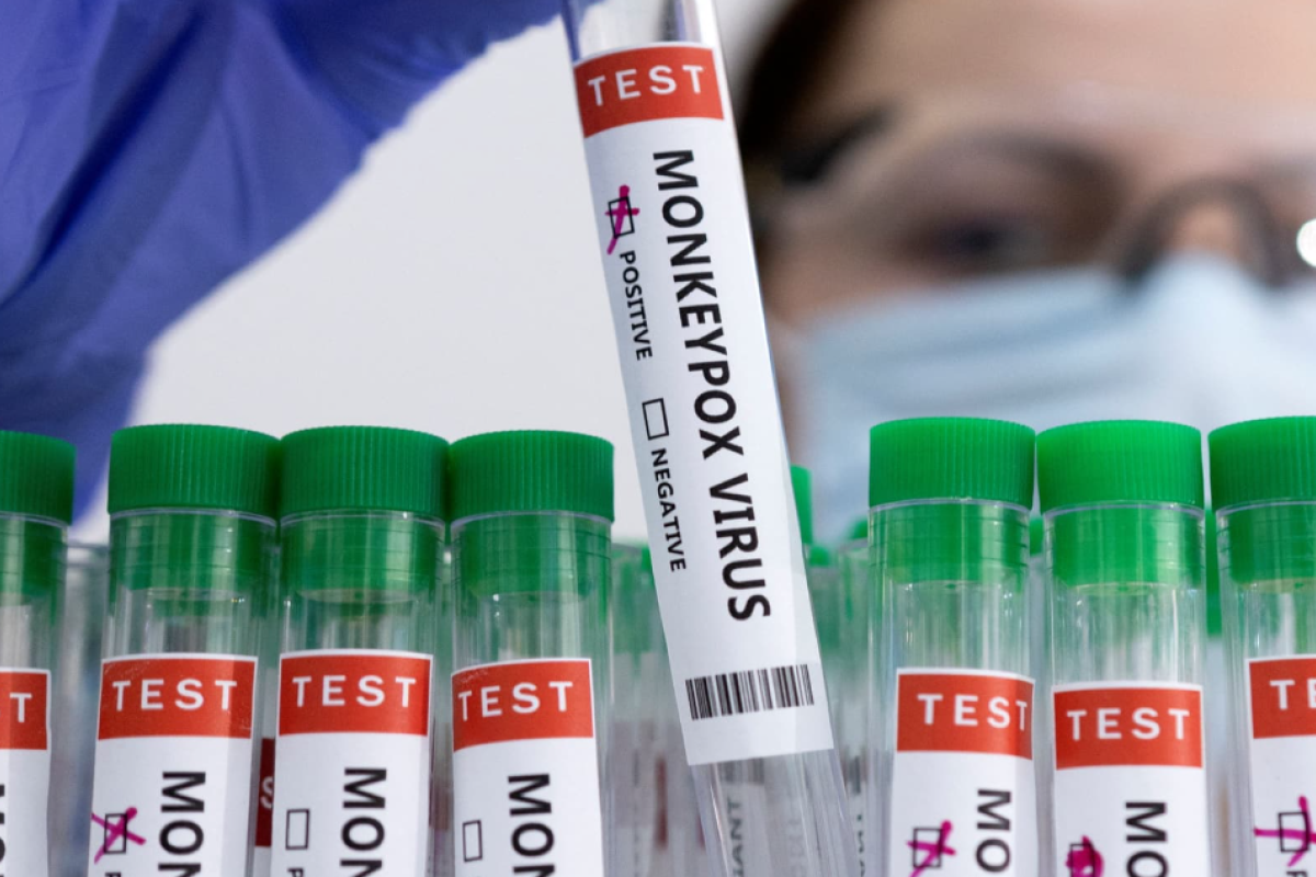 В Молдове подтвержден первый случай заражения оспой обезьян В Молдове подтвержден первый случай заражения оспой обезьян