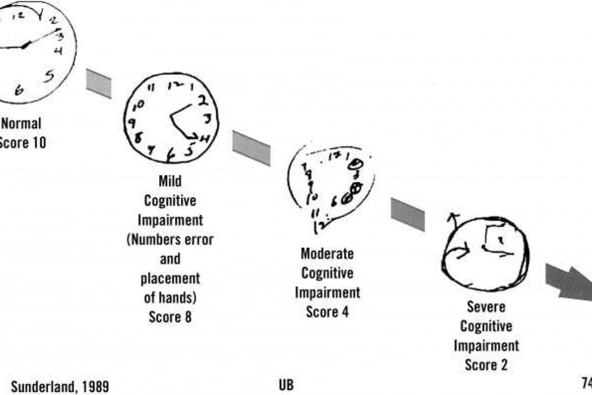 Цифровая ручка позволит диагностировать заболевания мозга на ранних стадиях, - исследователи