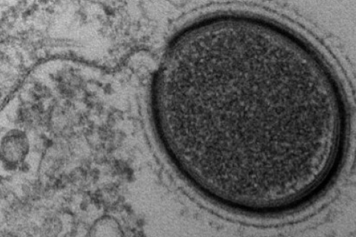 Российсике ученые хотят "разбудить" гигантский доисторический вирус